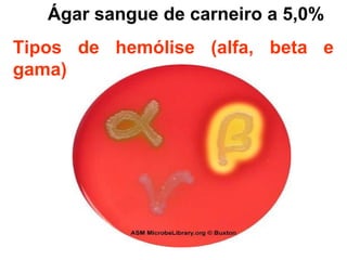 Ágar sangue de carneiro a 5,0%
Tipos de hemólise (alfa, beta e
gama)
 