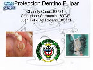 Proteccion Dentino Pulpar
Chanely Caba...83734.
Catherinne Carbuccia...83737.
Juan Felix Del Rosario...83771.
 