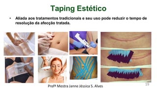 Taping Estético
• Aliada aos tratamentos tradicionais e seu uso pode reduzir o tempo de
resolução da afecção tratada.
Profª Mestra Janne Jéssica S. Alves 19
 