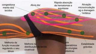 congestiona
mento dos
tecidos
Alivio dor
Melhoria da
função muscular
regulando o seu
tônus
Rápida absorção
de hematomas e
equimose
Melhora na
distribuição do tecido
cicatricial
pós
operatórios
de cirurgias
plásticas
Ativação
microcirculação
sg e drenagem
linfática
Estabilidade
grávidas
23
 