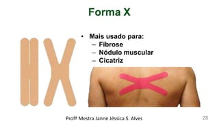 • Mais usado para:
– Fibrose
– Nódulo muscular
– Cicatriz
Forma X
Profª Mestra Janne Jéssica S. Alves 28
 