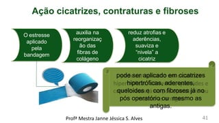 O estresse
aplicado
pela
bandagem
auxilia na
reorganizaç
ão das
fibras de
colágeno
reduz atrofias e
aderências,
suaviza e
“nivela” a
cicatriz
pode ser aplicado em cicatrizes
hipertróficas, aderentes,
queloides e com fibroses já no
pós operatório ou mesmo as
antigas.
Ação cicatrizes, contraturas e fibroses
Profª Mestra Janne Jéssica S. Alves 41
 