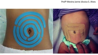 Profª Mestra Janne Jéssica S. Alves
43
 