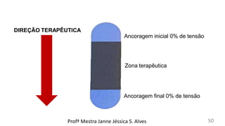 DIREÇÃO TERAPÊUTICA
Ancoragem inicial 0% de tensão
Ancoragem final 0% de tensão
Zona terapêutica
Profª Mestra Janne Jéssica S. Alves 50
 