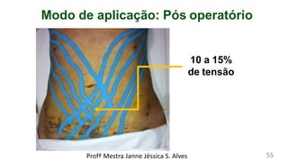 Modo de aplicação: Pós operatório
10 a 15%
de tensão
Profª Mestra Janne Jéssica S. Alves 55
 