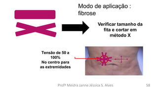 Verificar tamanho da
fita e cortar em
método X
Modo de aplicação :
fibrose
Profª Mestra Janne Jéssica S. Alves 58
Tensão de 50 a
100%
No centro para
as extremidades
 