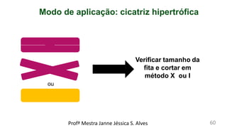 Modo de aplicação: cicatriz hipertrófica
Verificar tamanho da
fita e cortar em
método X ou I
ou
Profª Mestra Janne Jéssica S. Alves 60
 