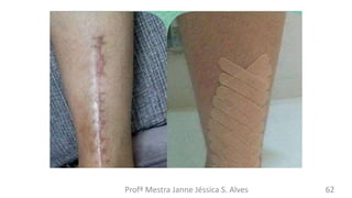 Profª Mestra Janne Jéssica S. Alves 62
 