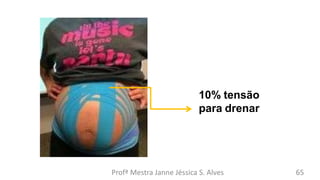 10% tensão
para drenar
Profª Mestra Janne Jéssica S. Alves 65
 