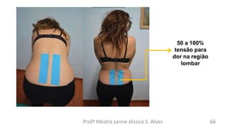 50 a 100%
tensão para
dor na região
lombar
Profª Mestra Janne Jéssica S. Alves 66
 