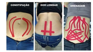 CONSTIPAÇÃO DOR LOMBAR DRENAGEM
71
 