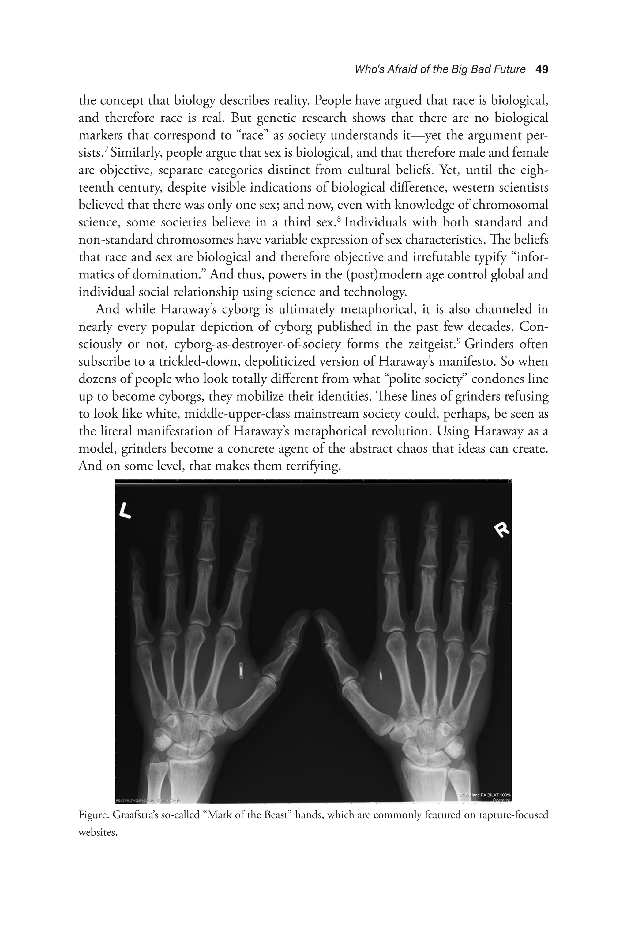 Who's Afraid of the Big Bad Future 49
the concept that biology describes reality. People have argued that race is biological,
and therefore race is real. But genetic research shows that there are no biological
markers that correspond to “race” as society understands it—yet the argument per-
sists.7
Similarly, people argue that sex is biological, and that therefore male and female
are objective, separate categories distinct from cultural beliefs. Yet, until the eigh-
teenth century, despite visible indications of biological difference, western scientists
believed that there was only one sex; and now, even with knowledge of chromosomal
science, some societies believe in a third sex.8
Individuals with both standard and
non-standard chromosomes have variable expression of sex characteristics. The beliefs
that race and sex are biological and therefore objective and irrefutable typify “infor-
matics of domination.” And thus, powers in the (post)modern age control global and
individual social relationship using science and technology.
And while Haraway’s cyborg is ultimately metaphorical, it is also channeled in
nearly every popular depiction of cyborg published in the past few decades. Con-
sciously or not, cyborg-as-destroyer-of-society forms the zeitgeist.9
Grinders often
subscribe to a trickled-down, depoliticized version of Haraway’s manifesto. So when
dozens of people who look totally different from what “polite society” condones line
up to become cyborgs, they mobilize their identities. These lines of grinders refusing
to look like white, middle-upper-class mainstream society could, perhaps, be seen as
the literal manifestation of Haraway’s metaphorical revolution. Using Haraway as a
model, grinders become a concrete agent of the abstract chaos that ideas can create.
And on some level, that makes them terrifying.
Figure. Graafstra’s so-called “Mark of the Beast” hands, which are commonly featured on rapture-focused
websites.
 
