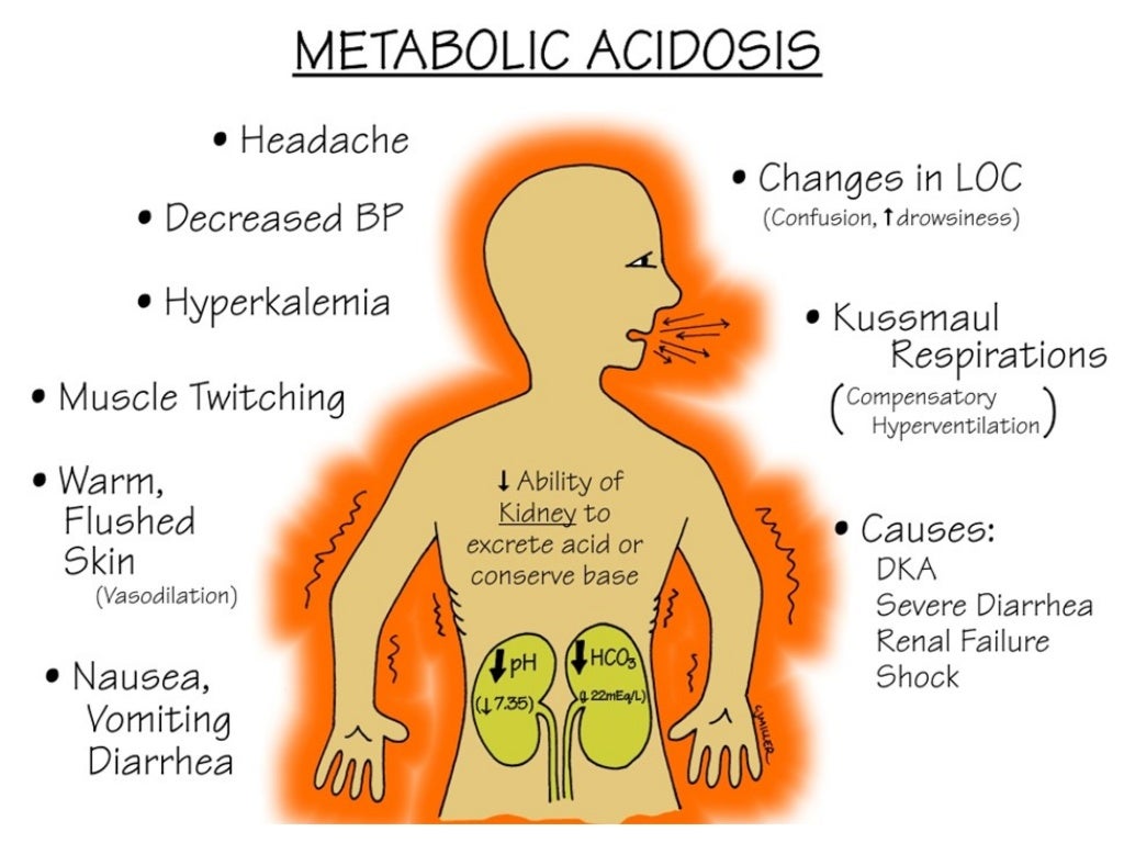 fluid, electrolytes, acid base balance