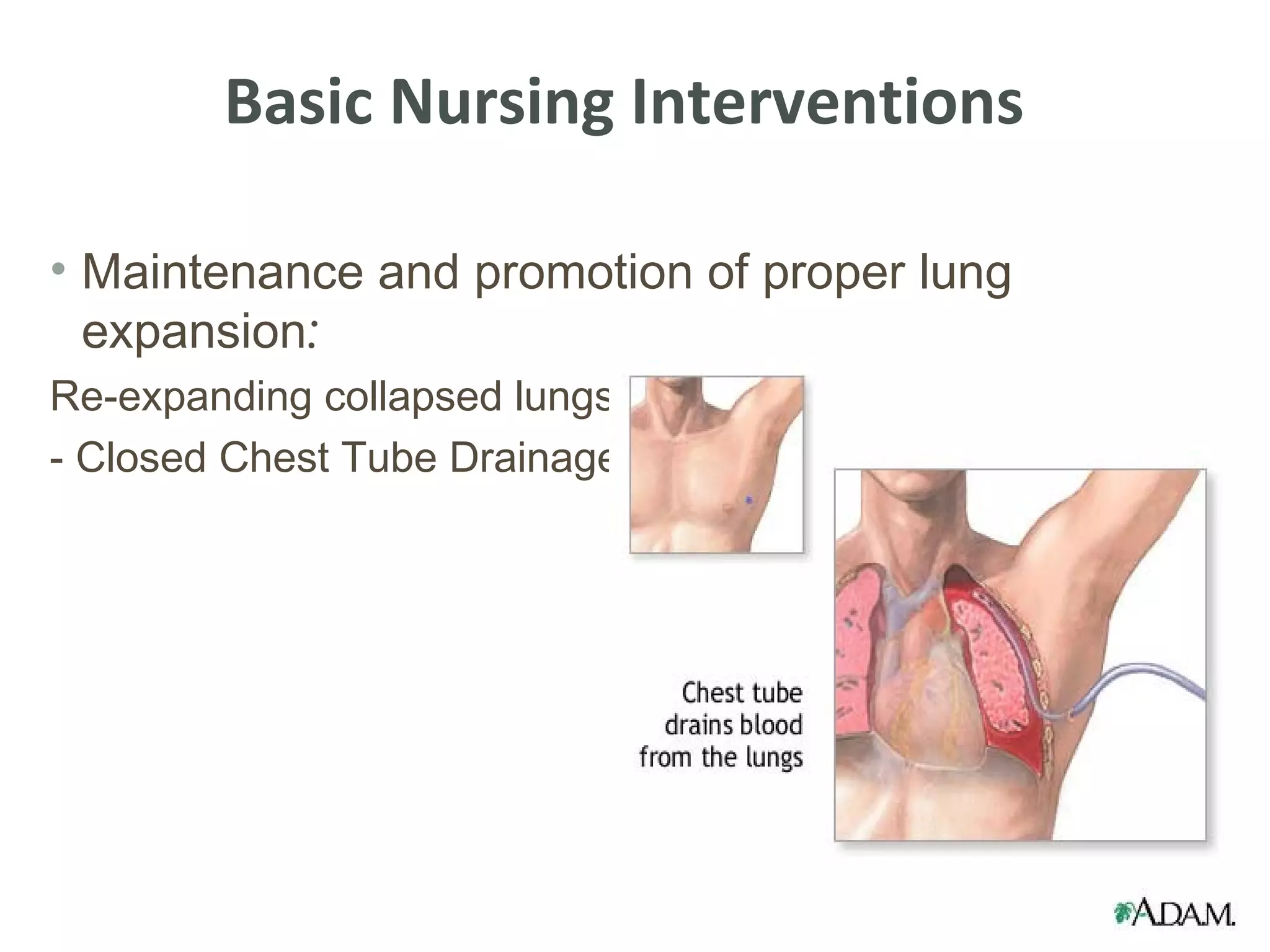 Basic Nursing Interventions

• Maintenance and promotion of proper lung
  expansion:
Re-expanding collapsed lungs
- Closed Chest Tube Drainage
 