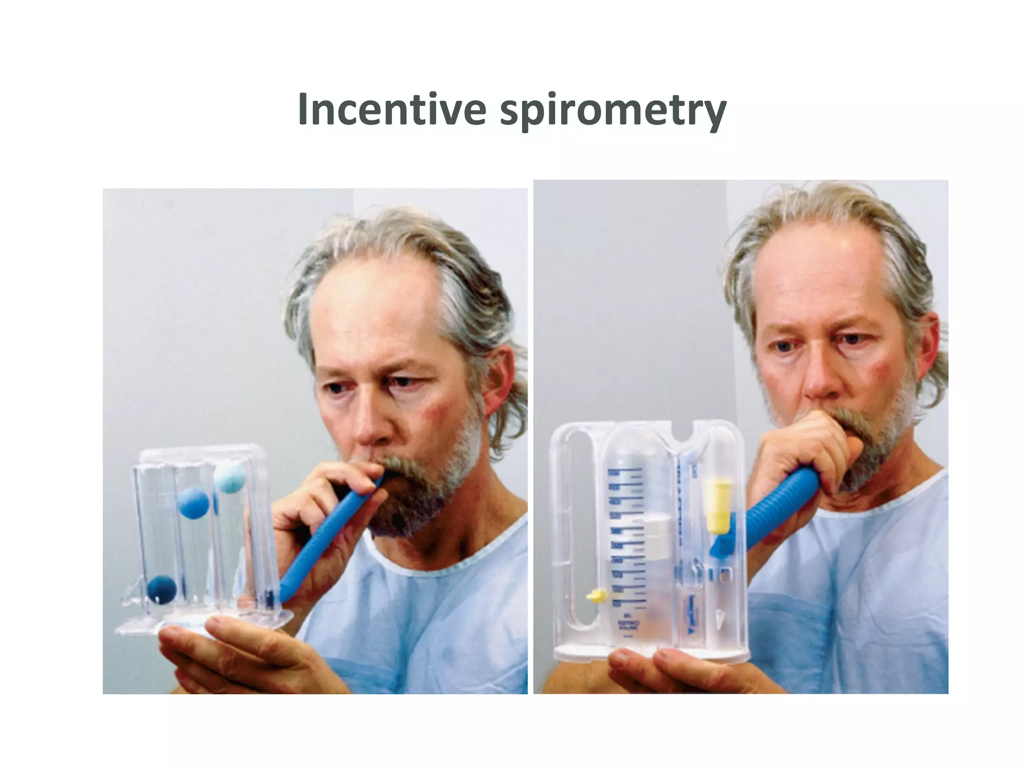 Incentive spirometry
 
