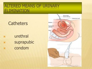 ALTERED MEANS OF URINARY
ELIMINATION


    Catheters

     urethral
     suprapubic
     condom
 