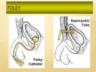 FOLEY
 