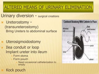 ALTERED MEANS OF URINARY ELIMINATION
Urinary diversion -             surgical creations

 Ureterostomy -
    (transureterostomy)
    Bring Ureters to abdominal surface


   Uterosigmoidostomy
   Ilea conduit or loop
    Implant ureter into ileum
        Form stoma
        Form pouch
              Need occasional catheterization to
               empty

   Kock pouch
 