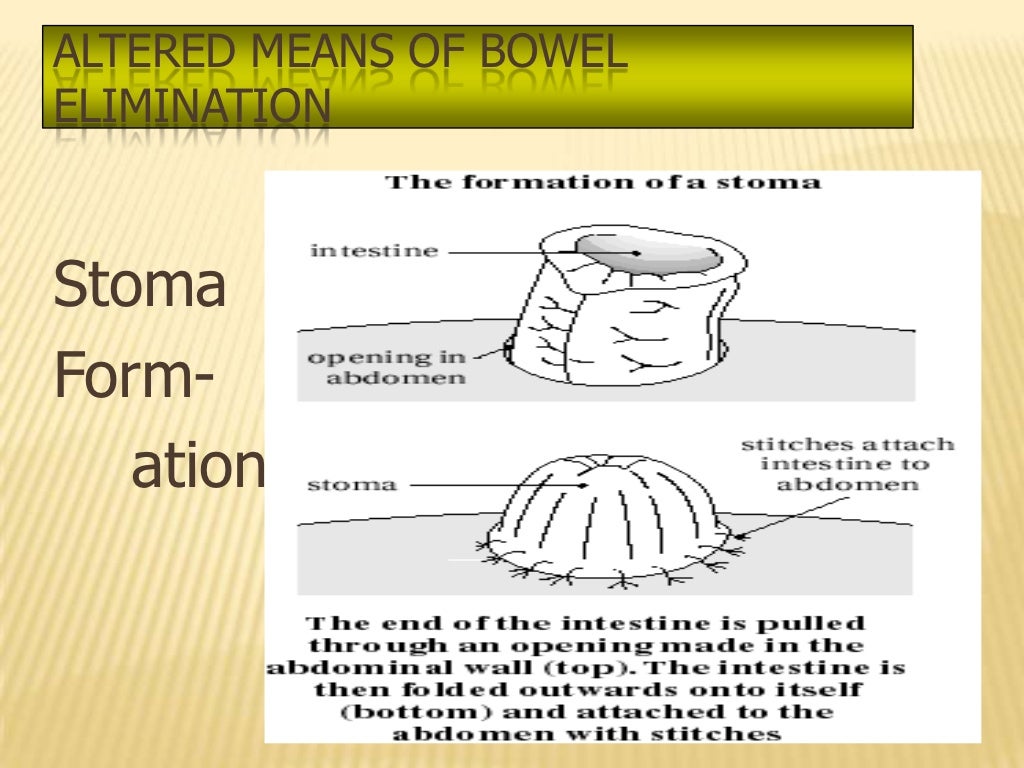 elimination, nursing
