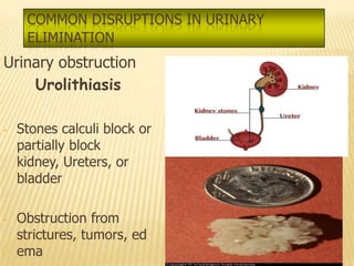 COMMON DISRUPTIONS IN URINARY
     ELIMINATION
Urinary obstruction
    Urolithiasis

-   Stones calculi block or
    partially block
    kidney, Ureters, or
    bladder

-   Obstruction from
    strictures, tumors, ed
    ema
 