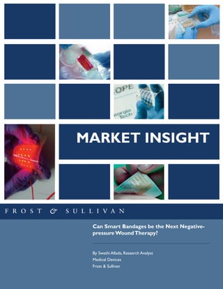 MARKET INSIGHT
Can Smart Bandages be the Next Negative-
pressure WoundTherapy?
By Swathi Allada, Research Analyst
Medical Devices
Frost & Sullivan
 