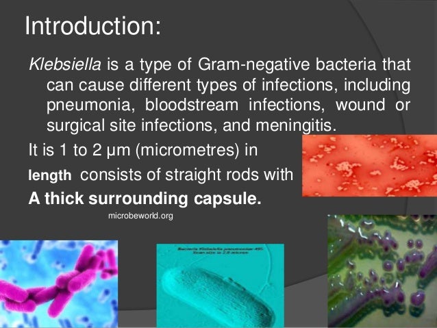 Spectacular How Do You Get Klebsiella Background Photography Spectacular How Do You Get Klebsiella Background Photography