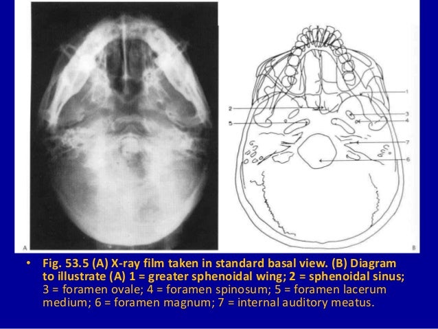 53 DAVID SUTTON PICTURES THE SKULL diagram of internal ear 