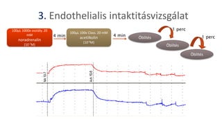 3. Endothelialis intaktitásvizsgálat
100μL 1000x osztály. 20
mM
noradrenalin
(10-7M)
100μL 100x Class. 20 mM
acetilkolin
(10-6M)
Öblítés4 min 1 perc
1 perc
Öblítés
Öblítés
4 min
 