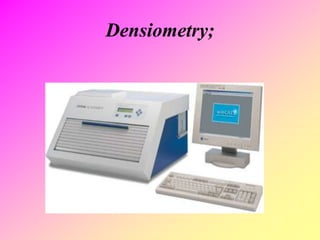 Densiometry;
 