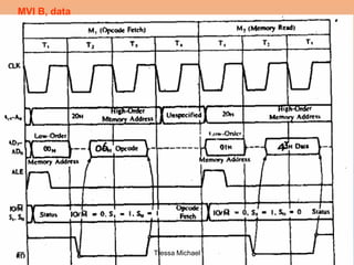 MVI B, data
Tressa Michael
 