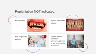 Replantation NOT indicated;
Severe caries Severe periodontal
disease
Non cooperative
patients
Severe medical
condition
(immunosuppressio
n and sever cardiac
conditions)
 