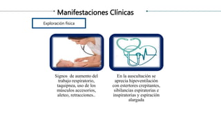 Manifestaciones Clínicas
Signos de aumento del
trabajo respiratorio,
taquipnea, uso de los
músculos accesorios,
aleteo, retracciones..
En la auscultación se
aprecia hipoventilación
con estertores crepitantes,
sibilancias espiratorias e
inspiratorias y espiración
alargada
Exploración física
 