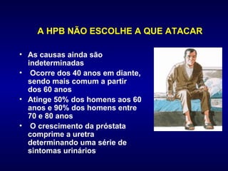      A HPB NÃO ESCOLHE A QUE ATACAR As causas ainda são indeterminadas Ocorre dos 40 anos em diante, sendo mais comum a partir dos 60 anos Atinge 50% dos homens aos 60 anos e 90% dos homens entre 70 e 80 anos O crescimento da próstata comprime a uretra determinando uma série de sintomas urinários                     
