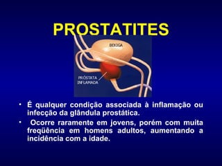PROSTATITES É qualquer condição associada à inflamação ou infecção da glândula prostática. Ocorre raramente em jovens, porém com muita freqüência em homens adultos, aumentando a incidência com a idade.  