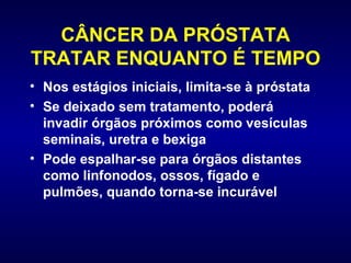 CÂNCER DA PRÓSTATA TRATAR ENQUANTO É TEMPO Nos estágios iniciais, limita-se à próstata Se deixado sem tratamento, poderá invadir órgãos próximos como vesículas seminais, uretra e bexiga Pode espalhar-se para órgãos distantes como linfonodos, ossos, fígado e pulmões, quando torna-se incurável 