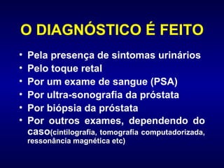 O DIAGNÓSTICO É FEITO Pela presença de sintomas urinários Pelo toque retal  Por um exame de sangue (PSA) Por ultra-sonografia da próstata  Por biópsia da próstata  Por outros exames, dependendo do caso (cintilografia, tomografia computadorizada, ressonância magnética etc) 