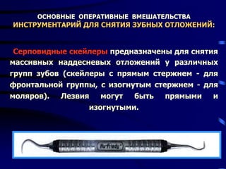 ОСНОВНЫЕ ОПЕРАТИВНЫЕ ВМЕШАТЕЛЬСТВА
ИНСТРУМЕНТАРИЙ ДЛЯ СНЯТИЯ ЗУБНЫХ ОТЛОЖЕНИЙ:
Серповидные скейлеры предназначены для снятия
массивных наддесневых отложений у различных
групп зубов (скейлеры с прямым стержнем - для
фронтальной группы, с изогнутым стержнем - для
моляров). Лезвия могут быть прямыми и
изогнутыми.
 