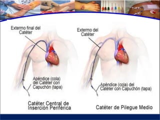 Cuidados de enfermería en accesos venosos - CICAT-SALUD