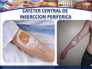 Cuidados de enfermería en accesos venosos - CICAT-SALUD