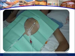 Cuidados de enfermería en accesos venosos - CICAT-SALUD