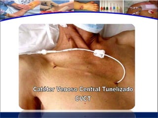 Cuidados de enfermería en accesos venosos - CICAT-SALUD
