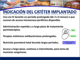 Una vía IV durante un período prolongado (de 3 a 6 meses) o que
carecen de acceso intravenoso periférico disponible.

Administración repetida y a largo plazo de tratamiento
quimioterápico.

Terapias sistémicas antibacterianas prolongadas.

Nutrición parenteral total durante largos períodos.

Acceso a largo plazo, continuo o intermitente, para toma de
muestras sanguíneas.
 