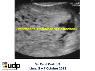 Enfermedad Trofoblástica Gestacional




          Dr. René Castro S.
       Lima, 5 – 7 Octubre 2012
 