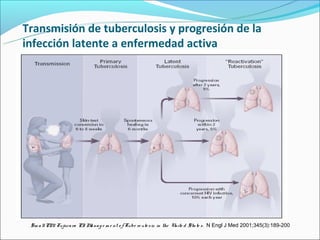 Transmisión de tuberculosis y progresión de la
infección latente a enfermedad activa




 S m a ll PM Fujiwa ra PI M na g e m e nt o f Tube rc ulo s is in the Unite d S ta te s . N Engl J Med 2001;345(3):189-200
            ,           . a
 