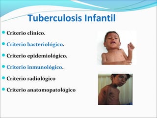 Tuberculosis Infantil
Criterio clínico.

Criterio bacteriológico.

Criterio epidemiológico.

Criterio inmunológico.

Criterio radiológico

Criterio anatomopatológico
 