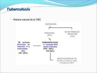 Tuberculosis

     Historia natural de la TBC
 