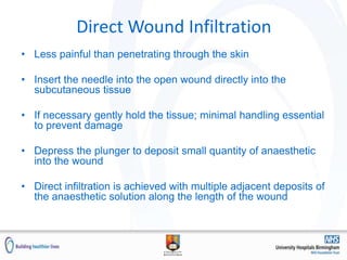Direct Wound Infiltration
• Less painful than penetrating through the skin
• Insert the needle into the open wound directly into the
subcutaneous tissue
• If necessary gently hold the tissue; minimal handling essential
to prevent damage
• Depress the plunger to deposit small quantity of anaesthetic
into the wound
• Direct infiltration is achieved with multiple adjacent deposits of
the anaesthetic solution along the length of the wound
 