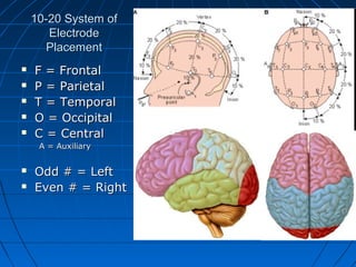10-20 System of10-20 System of
ElectrodeElectrode
PlacementPlacement
 F = FrontalF = Frontal
 P = ParietalP = Parietal
 T = TemporalT = Temporal
 O = OccipitalO = Occipital
 C = CentralC = Central
A = AuxiliaryA = Auxiliary
 Odd # = LeftOdd # = Left
 Even # = RightEven # = Right
 