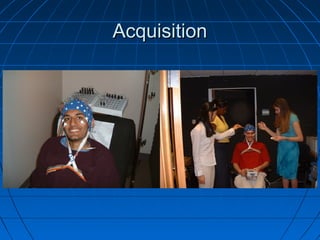 AcquisitionAcquisition
 