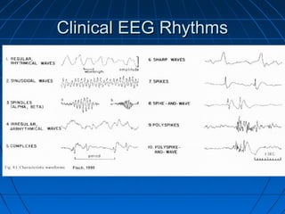 Clinical EEG RhythmsClinical EEG Rhythms
 